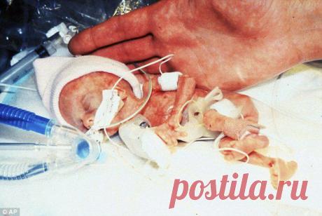 Малыш родился на три с половиной месяца раньше срока. Его отец сделал фильм о первом годе жизни сына. Копия видео за два дня собрала более миллиона просмотров. Очень трогательный фильм, посмотрите обязательно.