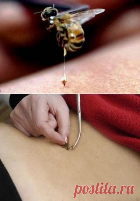 Пчелиный яд - польза и вред.