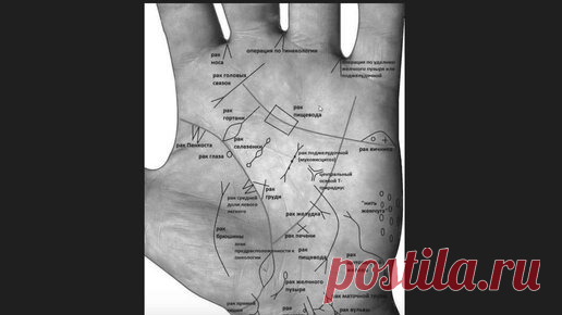 Хиромантия с Василисой Дождь | Здоровье по руке. Или почему не стоит ставить диагнозы себе по интернету? хиромантия