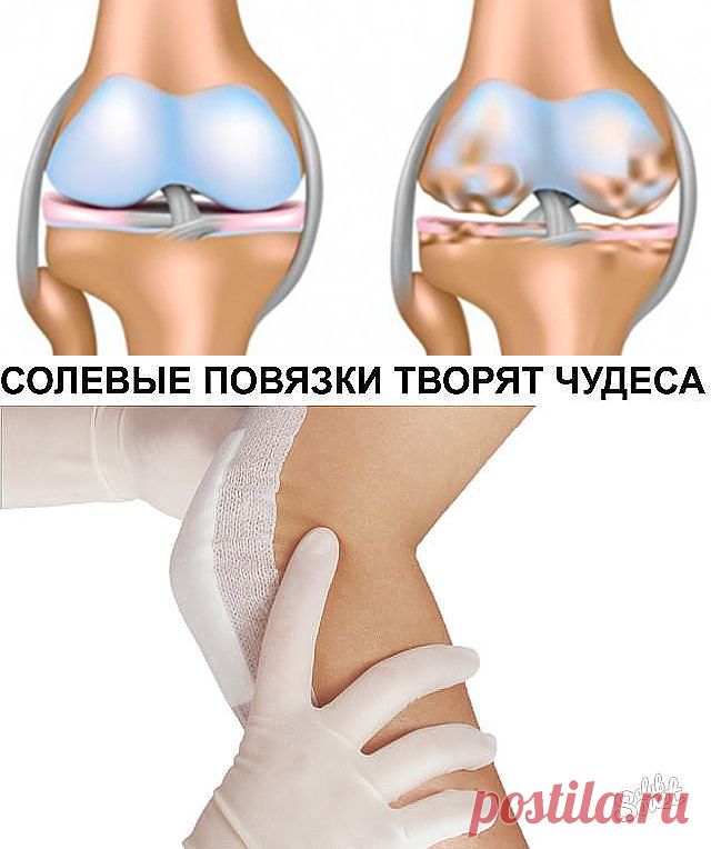 (1) Одноклассники