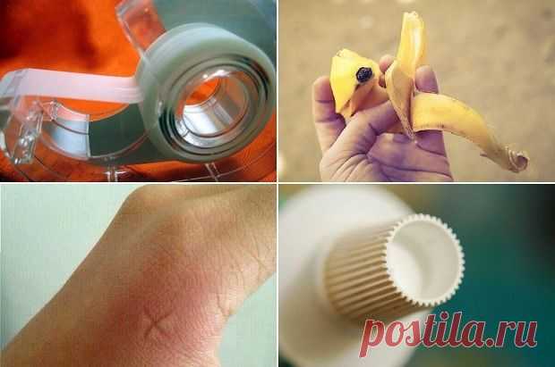 17 действенных советов, которые избавят вас от зуда после укусов комаров