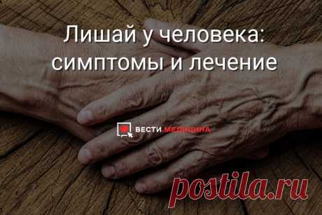 Лишай у человека: симптомы и лечение Худшее, что можно сделать, обнаружив лишай – заниматься самолечением.