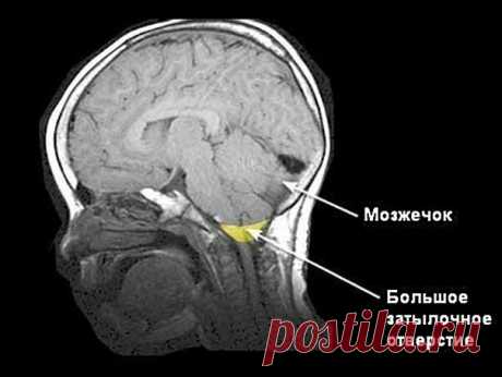 Зона исцеляющего воздействия, важная информация | Загадочное и необычное | Яндекс Дзен
