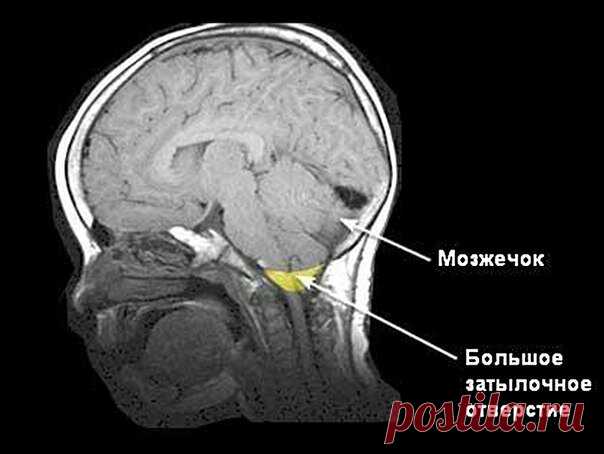 Зона исцеляющего воздействия, важная информация | Загадочное и необычное | Яндекс Дзен