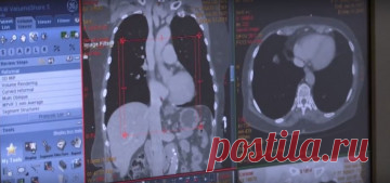 Рак легких: как заподозрить заболевание на ранней стадии