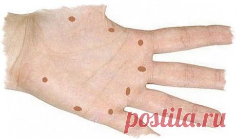 На ладонях существуют определенные точки, рефлекторно связанные с нашими органами. Воздействуя на эти точки, можно влиять на работу соответствующих органов.

Эта древняя техника схожа с иглоукалыванием. Достаточно надавливать на нужную точку в течение 5 минут, дышать при этом следует спокойно.

1. Большой палец.
При нажатии на эту точку может решить такие проблемы, как кашель, затрудненное дыхание, а также улучшить функцию щитовидной железы.

2. Большой палец.
Эта точка мо...