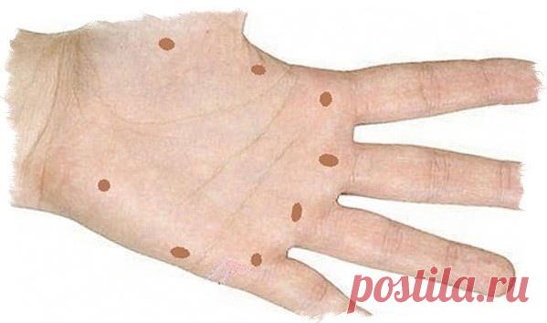 На ладонях существуют определенные точки, рефлекторно связанные с нашими органами. Воздействуя на эти точки, можно влиять на работу соответствующих органов.

Эта древняя техника схожа с иглоукалыванием. Достаточно надавливать на нужную точку в течение 5 минут, дышать при этом следует спокойно.

1. Большой палец.
При нажатии на эту точку может решить такие проблемы, как кашель, затрудненное дыхание, а также улучшить функцию щитовидной железы.

2. Большой палец.
Эта точка мо...