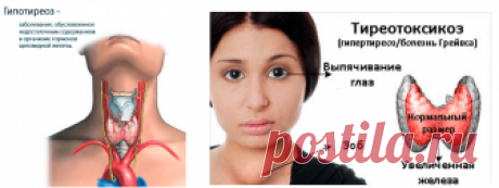 В каких продуктах содержится йод, чем он важен для здоровья, суточная норма для взрослого и ребенка Йод - важный для человека химический элемент, обеспечивающий нормальное функционирование эндокринной системы. В каких продуктах он содержится?