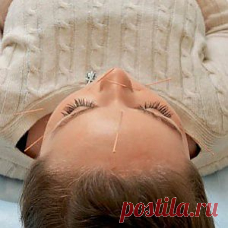 Укол молодости: как сделать лицо гладким и свежим