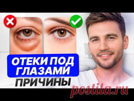 Убираем ОТЁКИ И МЕШКИ под глазами БЕЗ КОСМЕТИКИ! / Все неочевидные причины и эффективные решения
