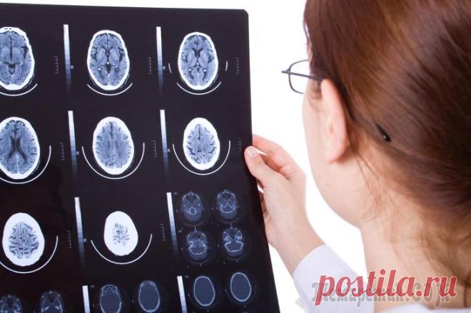 Рак мозга – симптомы, признаки, стадии, диагностика и лечение Онкологическая опухоль – коварное новообразование, которое может появиться абсолютно в любой части тела и длительное время развиваться бессимптомно, значительно снижая шансы человека на дальнейшую здо...