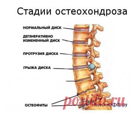 Здравотдел. Упражнения при остеохондрозе, сутулости, для коленных суставов