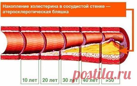 НАРОДНЫЕ СРЕДСТВА — Умный совет