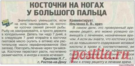 Косточки на ногах у большого пальца