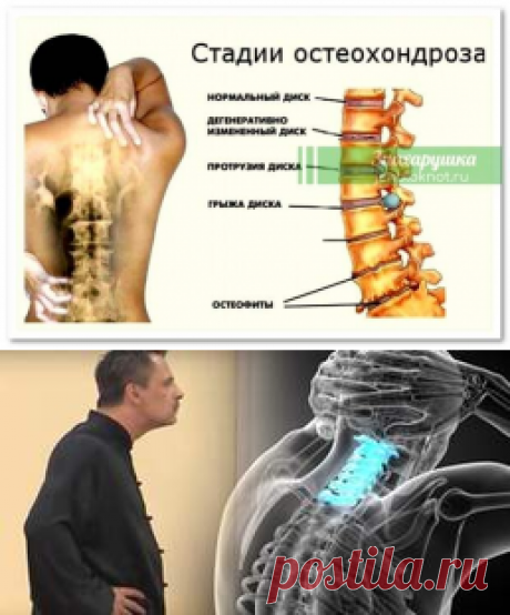 Сенсационная гимнастика Бутримова для шеи: нормализует кровообращение и положение позвонков
