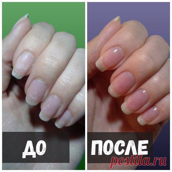 КАК СДЕЛАТЬ НОГТИ НАМНОГО КРЕПЧЕ? 
Сможет любая девушка и без особых затрат!

Ванночка для ногтей с маслом и йодом: 
Нужно 2 столовые ложки растительного масла, 1 чайную ложку 5%-ной настойки йода и 1 стакан воды. 

Разведите йод в воде. Вмешайте в раствор масло и всю полученную смесь подогрейте на водяной бане. Смесь как следует перемешайте до получения однородной массы. 

Опустить ногти в теплую ванночку и держать 10-15 минут.