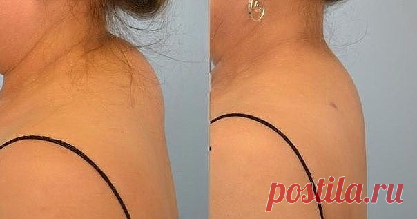 Одноклассники