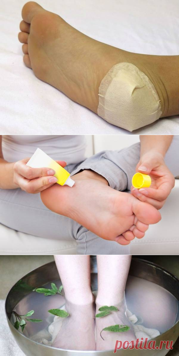 Как сделать пятки мягкими и гладкими в домашних условиях | Народные знания от Кравченко Анатолия