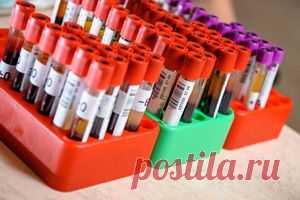 Как расшифровать анализ крови на биохимию