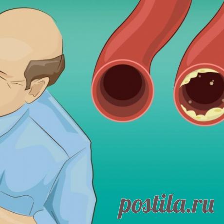 20 продуктов, которые прочистят артерии и защитят от сердечного приступа. Ешь их больше – живи дольше!