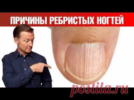 О чем кричат ваши ногти? Не лечите симптом, ищите ПРИЧИНУ✅