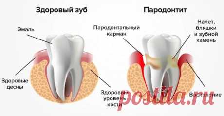 Как сохранить здоровье зубов до старости / Будьте здоровы