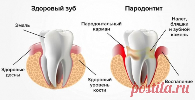 Как сохранить здоровье зубов до старости / Будьте здоровы