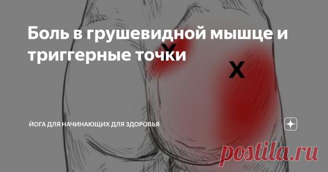 Боль в грушевидной мышце и триггерные точки Статья автора «Йога для начинающих для здоровья» в Дзене ✍:   Боль в грушевидной мышце и триггерные точки Боль в грушевидной мышце нередко связана с триггерными точками.
