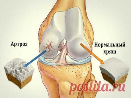 ДОМАШНИЙ НАПИТОК, КОТОРЫЙ ПОМОЖЕТ СУСТАВАМ
