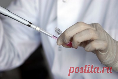 Преимплантационная диагностика