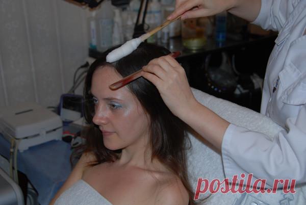 С чем связано выпадение волос: видео-инструкция по уходу своими руками, особенности процессов после наркоза, могут ли выпадать от краски, антибиотиков, от нервов, из-за низкого ферритина, цена, фото