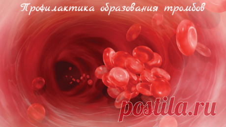 Профилактика образования тромбов