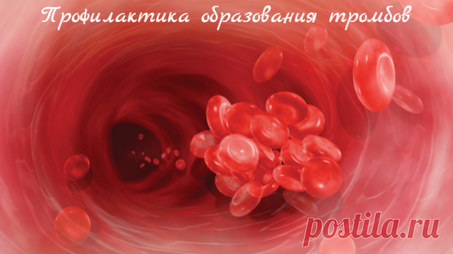 Профилактика образования тромбов