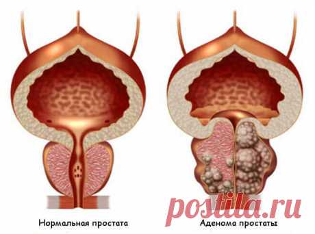 Новости.Ru: Очередной заговор российских аптек