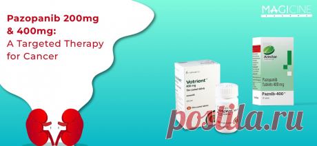 Paznib is an anti-cancer prescription medication that contains the active ingredient pazopanib. This medicine comes in two strengths which are 200mg and 400mg. The pazopanib tablet can be administered orally. This regimen is prescribed for the treatment of those patients who are suffering from renal cell carcinoma (kidney cancer). The pazopanib tablet can also be prescribed for the treatment of metastatic soft tissue sarcoma. This medication is specifically used when the patients have undergone