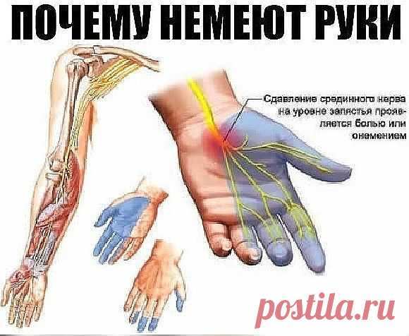 Почему немеют руки: 7 причин, заставляющих задуматься о здоровье. 
Каждому человеку не раз приходилось сталкиваться с ощущением потери чувствительности ноги или руки, сопровождающимся легким покалыванием или жжением. Зачастую это происходит из-за временного нарушения кровообращения в конечности вследствие сдавливания сосудов и нервных окончаний. Стоит начать двигаться или сменить положение, и чувствительность восстанавливается. 
И всё-таки неудобное положение во время сна,...