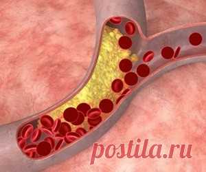 Эксперты рассказали, как избавиться от смертельных болезней - health info