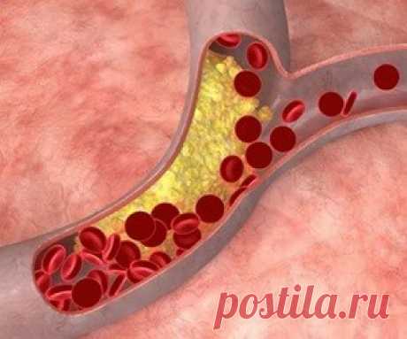Эксперты рассказали, как избавиться от смертельных болезней - health info