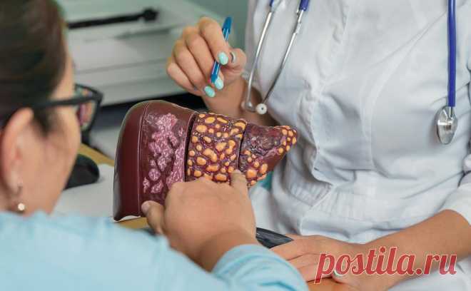 The Lancet назвал три способа предупредить рак печени. Более 60% случаев заболевания раком печени можно предупредить, снизив уровень потребления алкоголя и вовремя диагностировав и начав лечение жировой болезни печени и вирусных гепатитов, говорится в исследовании, опубликованном в журнале Lancet.