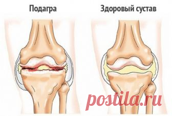 Отличный рецепт от боли в суставах 

Простейший народный рецепт для лечения суставов. 
(не смотрите, что простой, очень много отзывов об эффективности этого рецепта!) 

Наверняка многие не по наслышке знают, что такое боли в суставах. Какой, мягко скажем, дискомфорт доставляют они человеку. 
А народный рецепт лечения суставов необычайно прост, к тому же безопасен. 

1 ч. ложку пищевого желатина заливаем остывшей кипяченой водой (0,5 стакана) и оставляем на ночь. 

Утром до...