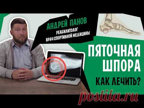 Боль в пятке и пяточная шпора. Симптомы и лечение фасциита | Андрей Панов