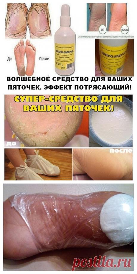 ВОЛШЕБНОЕ СРЕДСТВО ДЛЯ ВАШИХ ПЯТОЧЕК. ЭФФЕКТ ПОТРЯСАЮЩИЙ!