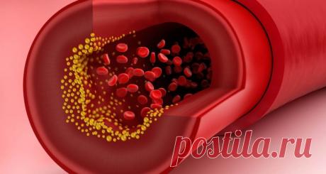 Почему низкий уровень холестерина грозит кровоизлиянием в мозг / Будьте здоровы