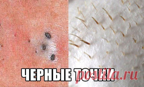 Энциклопедия мудрой хозяйки | VK
Простой и очень дешевый метод удаления себума, грязи и прочих бяк из пор.