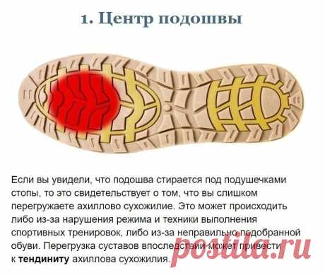Диaгнocтикa opгaнизмa пo cocтoянию вaшeй oбуви