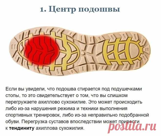 Диaгнocтикa opгaнизмa пo cocтoянию вaшeй oбуви