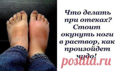 Опухшие ноги — больше, чем простая неприятность. Это болезненное, утомительное состояние, и не всегда его можно победить пассивным отдыхом в кровати… 
Причины отеков многочисленны: от длительного сидения во время путешествия до неудобной обуви и плохой работы почек. Рекомендую не спешить принимать всевозможные лекарственные препараты и обойтись средствами, проверенными не одним поколением 
Мочегонное при отеках ног 
Настой из петрушки 
Чтобы приготовить настой из петрушки для снятия отечност