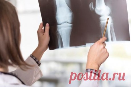 Истощение сустава. Как справиться с артрозом | Здоровая жизнь | Здоровье | Аргументы и Факты