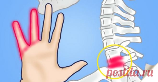 Онемение рук сигнализирует об опасных болезнях