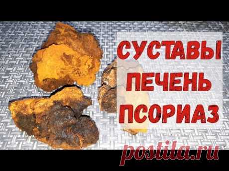 Нормализовался сахар. УНИКАЛЬНОЕ средство. ЧАГА, как настаивать и пить.